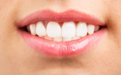 Se me ha roto un diente, ¿Qué hago?