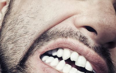 Todo lo que debes saber sobre los implantes dentales